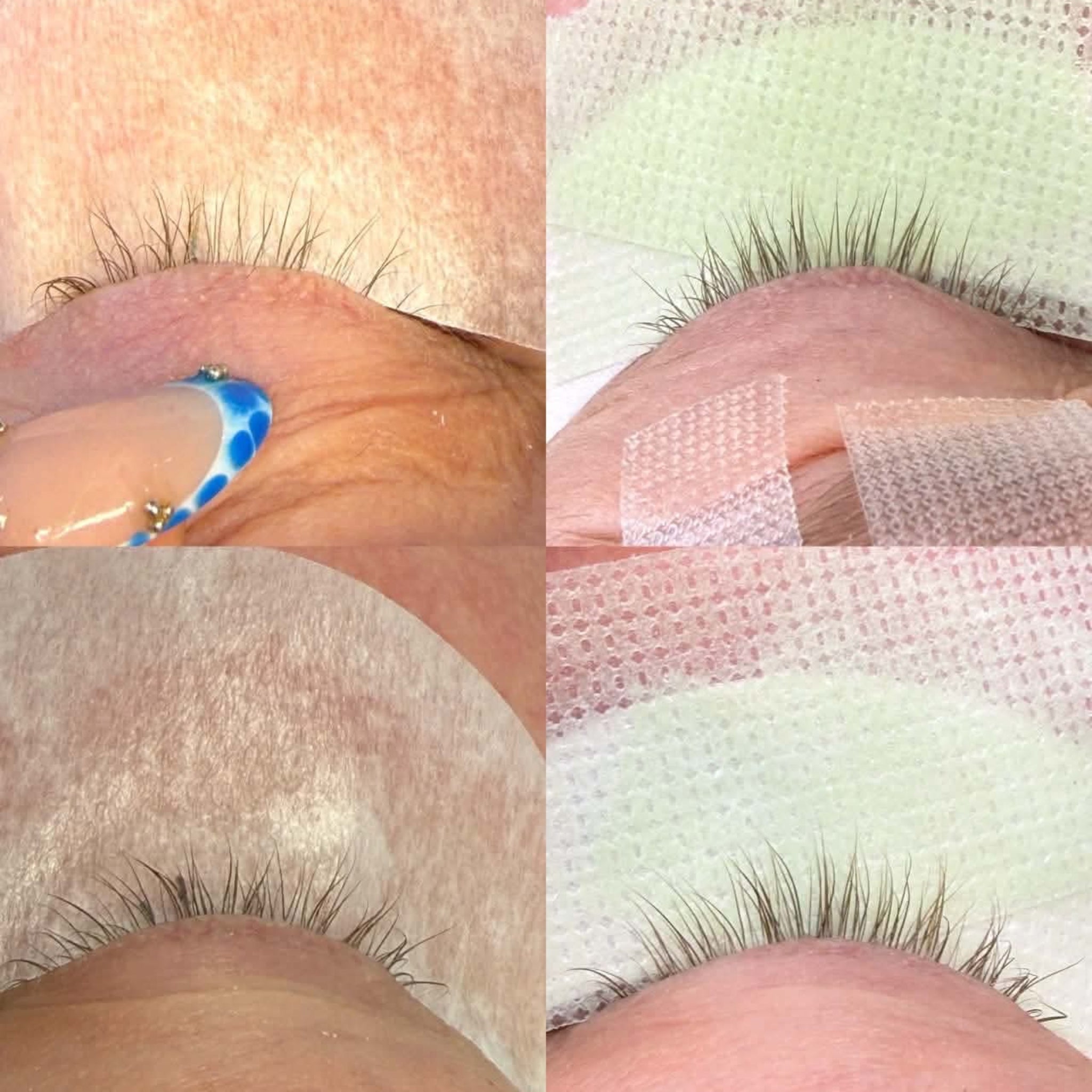 Ladybug Lashes Prostaglandin-free Lash & Brow Growth Serum before and after collage showing four close-up shots of natural lashes — sparse and uneven before use, visibly fuller and more uniform after — demonstrating real growth results from consistent serum application
