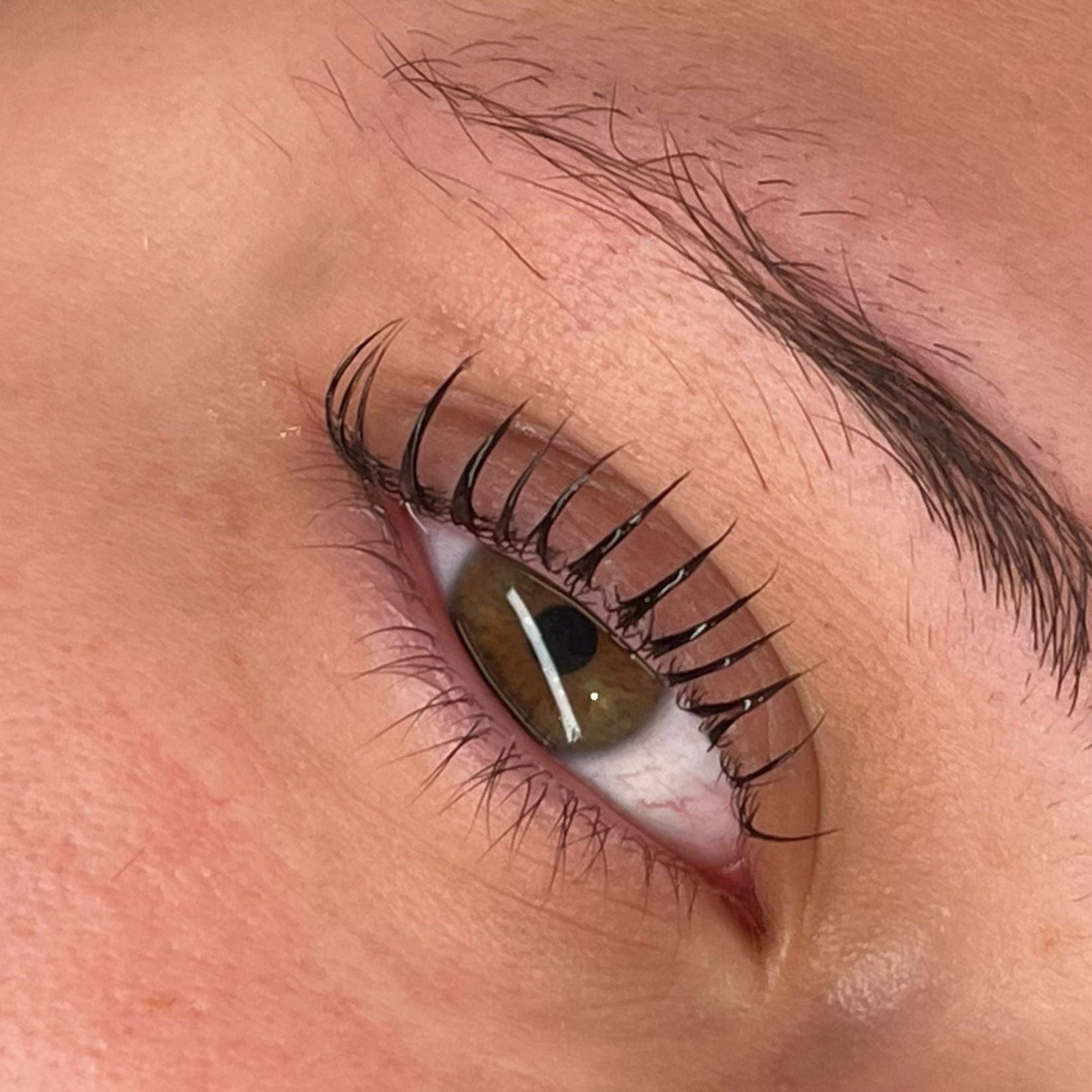 Close-up eye treatment result – LADYBUGLASHES Express Cysteamine System